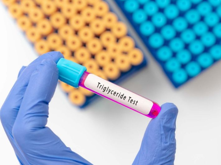 تحاليل الدهون